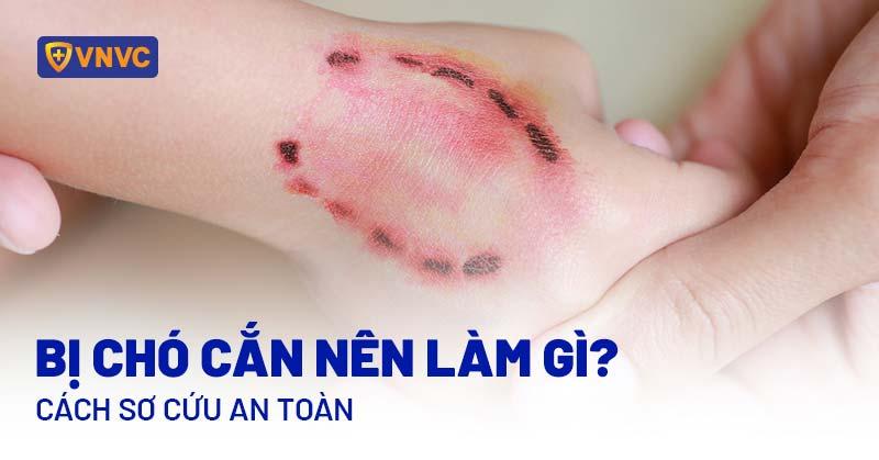 Cẩn thận với chó lạ