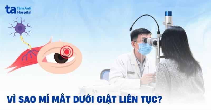 Khi nào cần đi khám bác sĩ vì mí mắt giật?