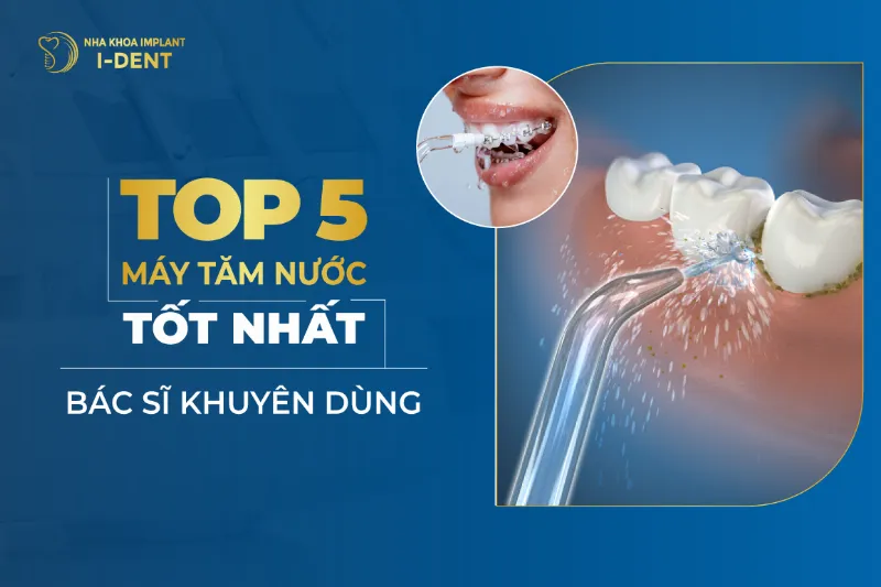 Kinh nghiệm chọn mua máy cấy