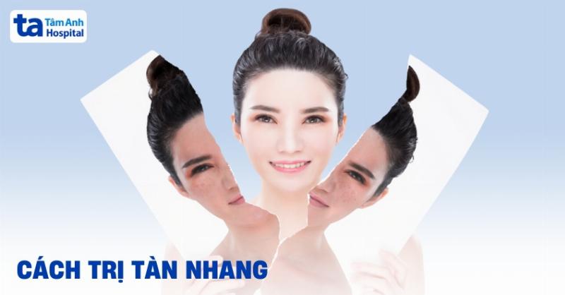 Tàn nhang cong dưới góc nhìn khoa học