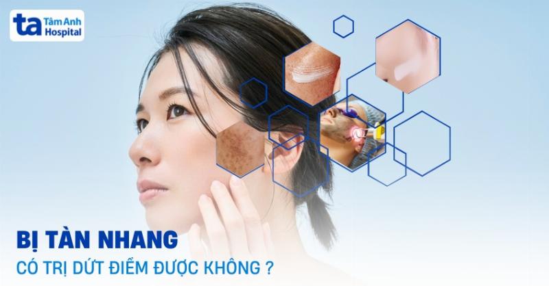 Tàn nhang cong ở các vị trí khác nhau